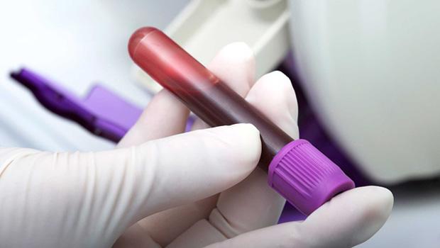 Global Genomics Group (G3) Granted Patent for Breakthrough Diagnostic Blood Test for Plaque Detection in the Heart